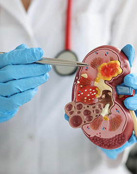 KIDNEY DISEASES